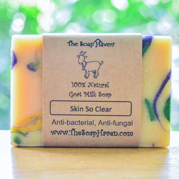 Skin So Clear Goat Milk Soap (Popular! Great for Acne, White Spots, Oily Skin, Anti-fungal)